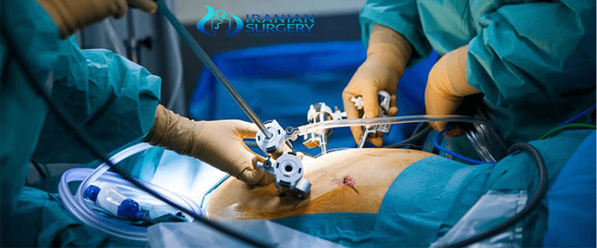 Different Types Of Laparoscopy Surgery