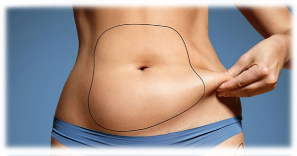 Tummy tuck in Iran