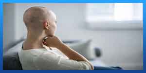 هل العلاج الاشعاعي يسقط الشعر؟