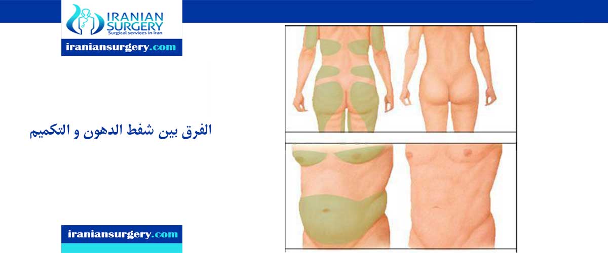 الفرق بین شفط الدهون و التکمیم