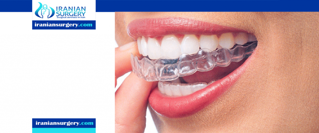 invisalign in iran