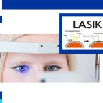 lasek eye surgery in iran