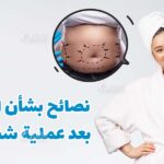 متى اقدر استحم بعد عملية شفط الدهون؟