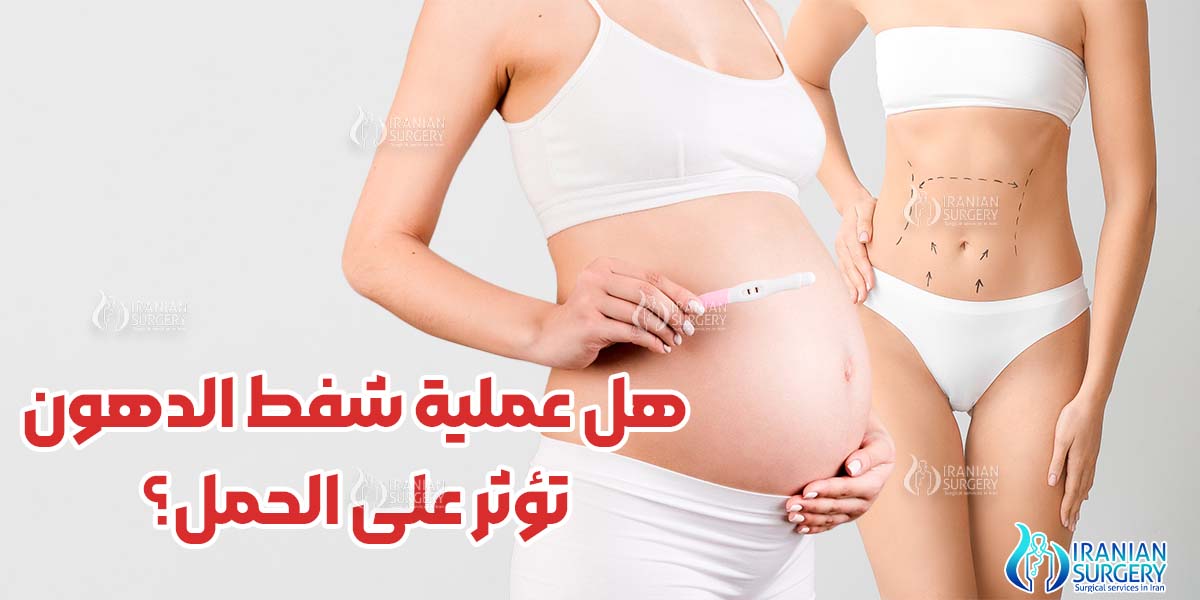 هل عملية شفط الدهون تؤثر على الحمل؟