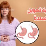 فشل عملية تحويل مسار المعدة