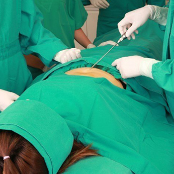 عمل لیپوماتیک بهترین روش لاغری موضعی