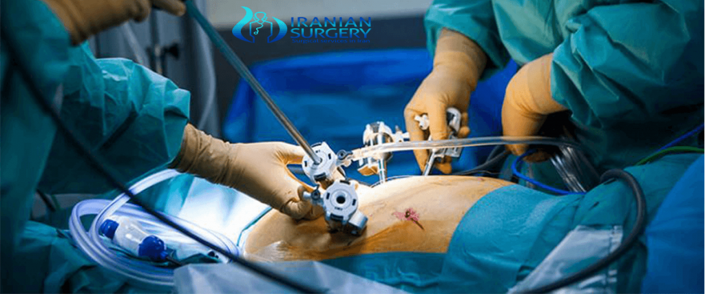 laparoscopy-cost-laparoscopy-scars-laparoscopy-recovery-time