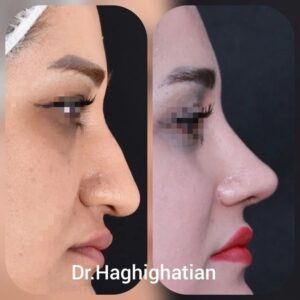 Dr. Ali Haghighatian