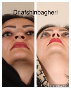 Dr. Afshin Bagheri