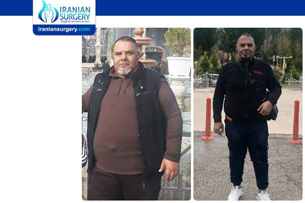 انقاص الوزن في ایران