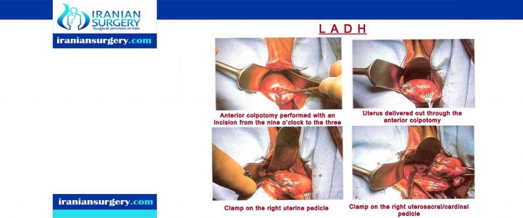 Anterior colpotomy procedure