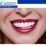 Are Porcelain Veneers Permanent