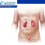 Bladder cancer symptoms in men