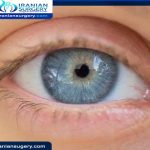 Blue water EYE DISEASE