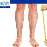 LEG LENTHENING SURGERY