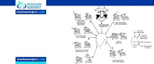 Cervical Fracture Types