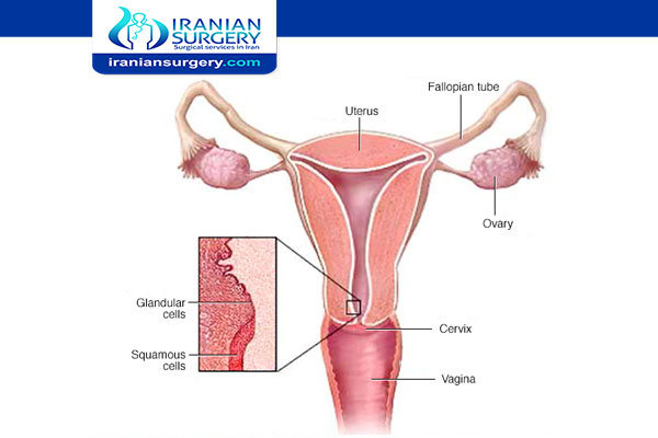 Cervical cancer staging and treatment