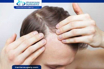 اضرار زراعة الشعر بالاقتطاف