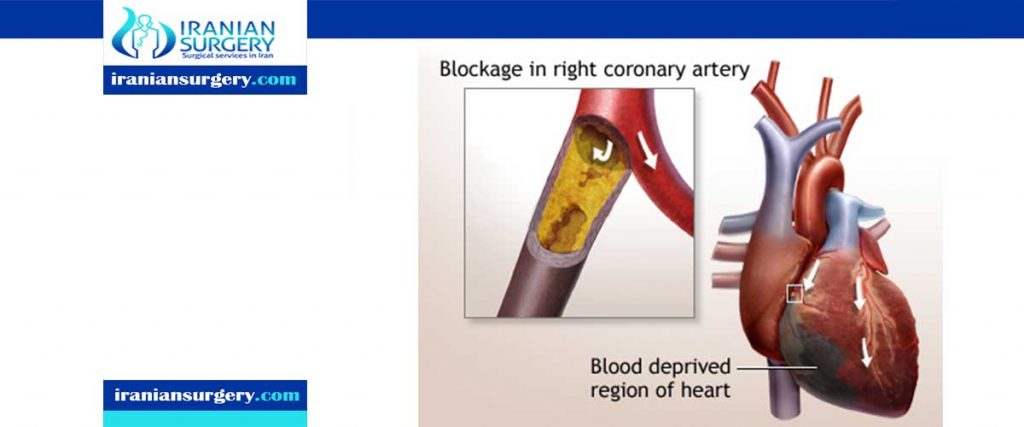 Closed heart surgery indications