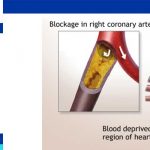 Closed heart surgery indications