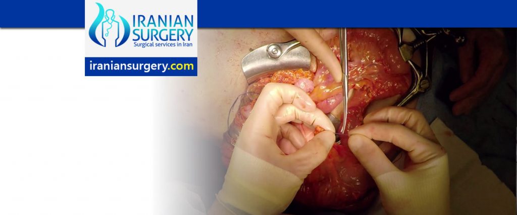 Colectomy surgery in Iran