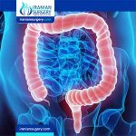 Colorectal hospitals in Iran