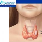 Common side effects of thyroid cancer treatment
