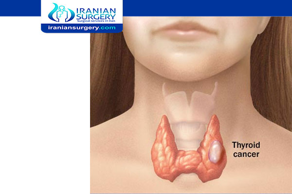 Common side effects of thyroid cancer treatment