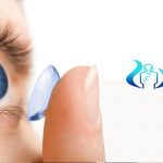 contact lens