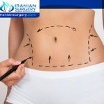 Coolsculpting vs Liposuction