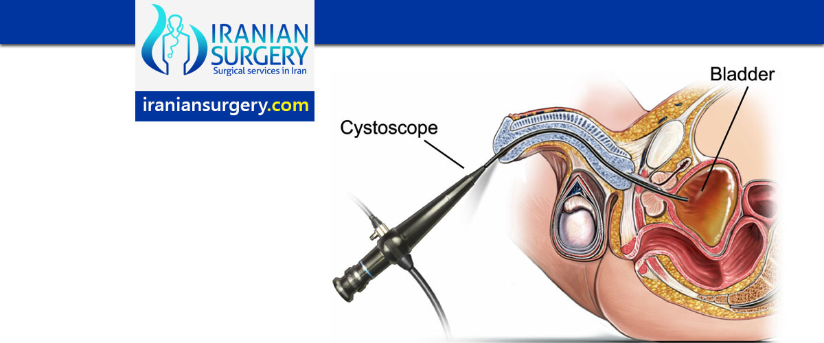 Cystoscopy procedure in Iran