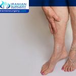 Deep vein thrombosis treatment