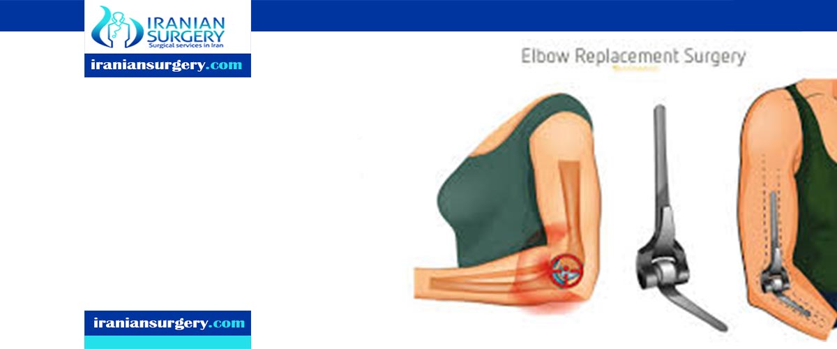 Elbow Replacement Surgery Success Rate
