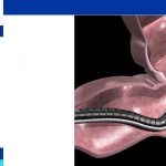 Endoscopy in Iran