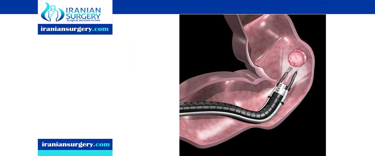 Endoscopy in Iran