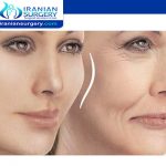 Facial Fat Grafting in Iran