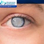 Glaucoma treatment in Iran