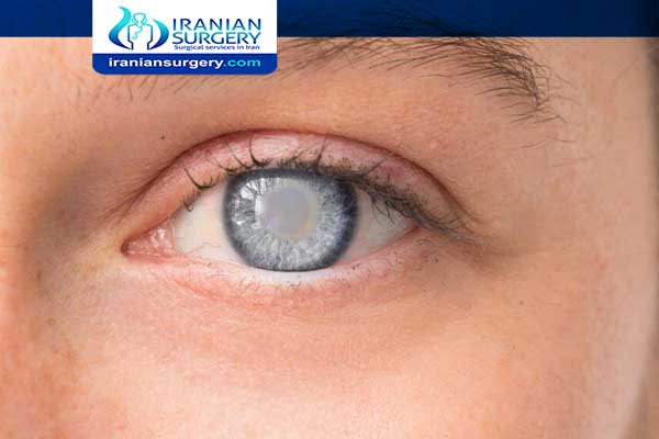Glaucoma treatment in Iran