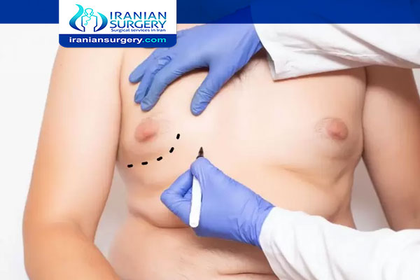 Gynecomastia surgery in Iran