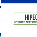 HIPEC surgery in Iran