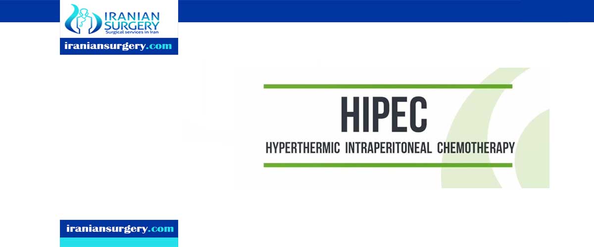 HIPEC surgery in Iran