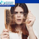 علاج سقوط الشعر بعد التكميم