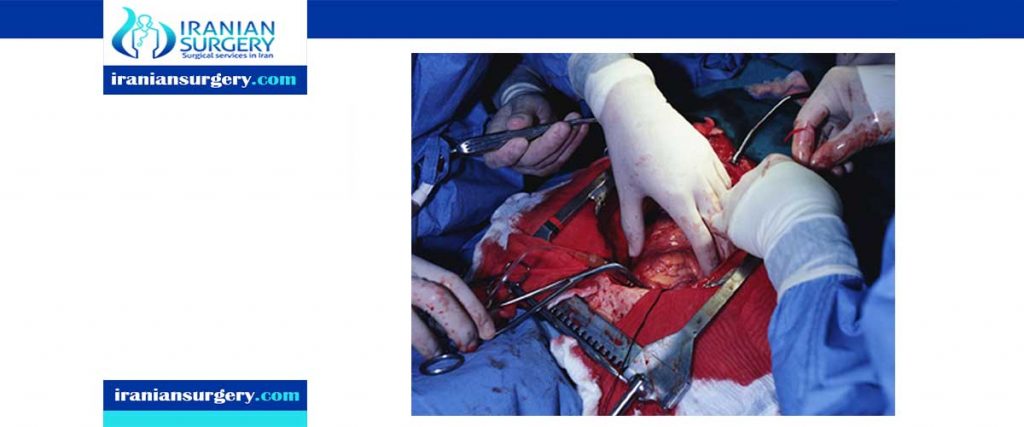 Heart bypass surgery procedure