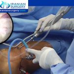 Hip Arthroscopy