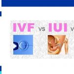 iui vs ivf vs icsi