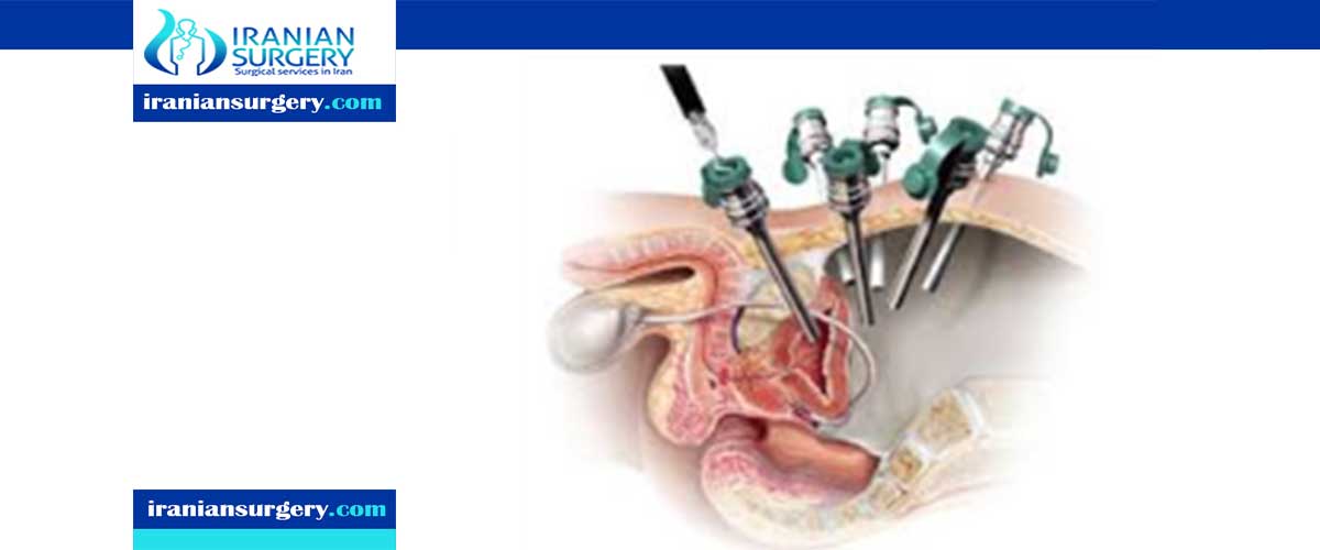 In laparoscopic prostatectomy