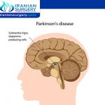 هل مرض باركنسون وراثي؟