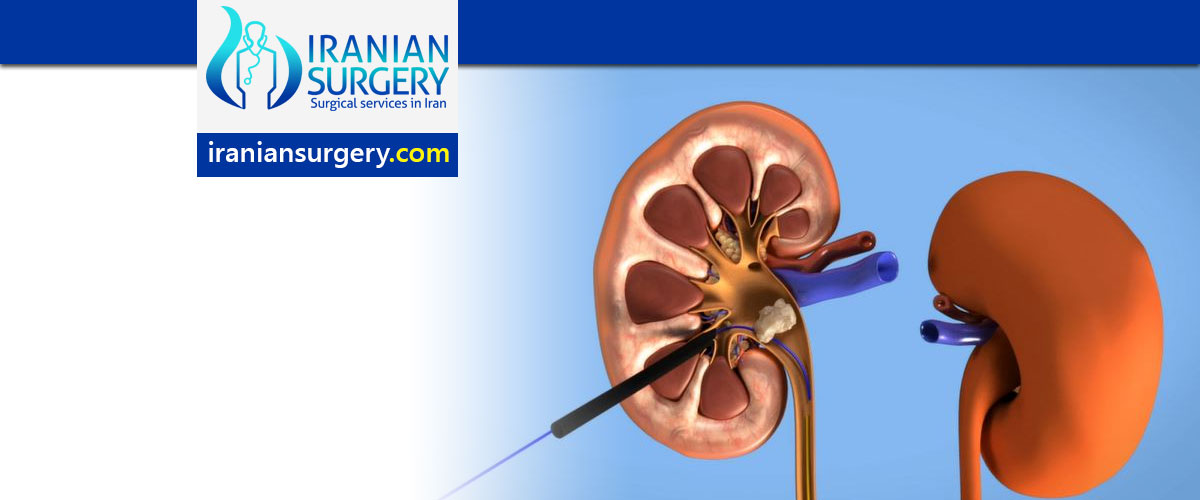 Kidney Stone Surgery in Iran