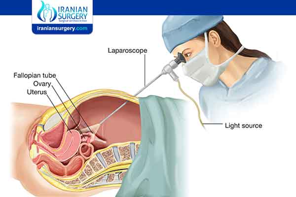 Laparoscopic Surgery cost