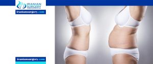 Liposuction alternative